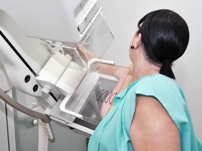 Periperi recebe mutirão de exames de mamografia gratuitos
