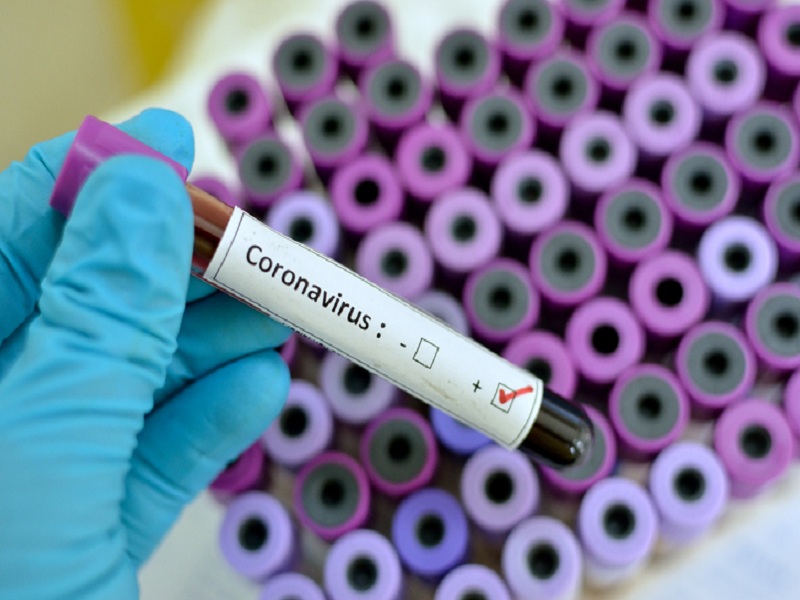Alerta: Subúrbio tem 27 casos confirmados de coronavírus (covid-19)